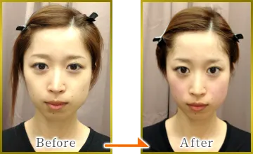 ビフォーアフター